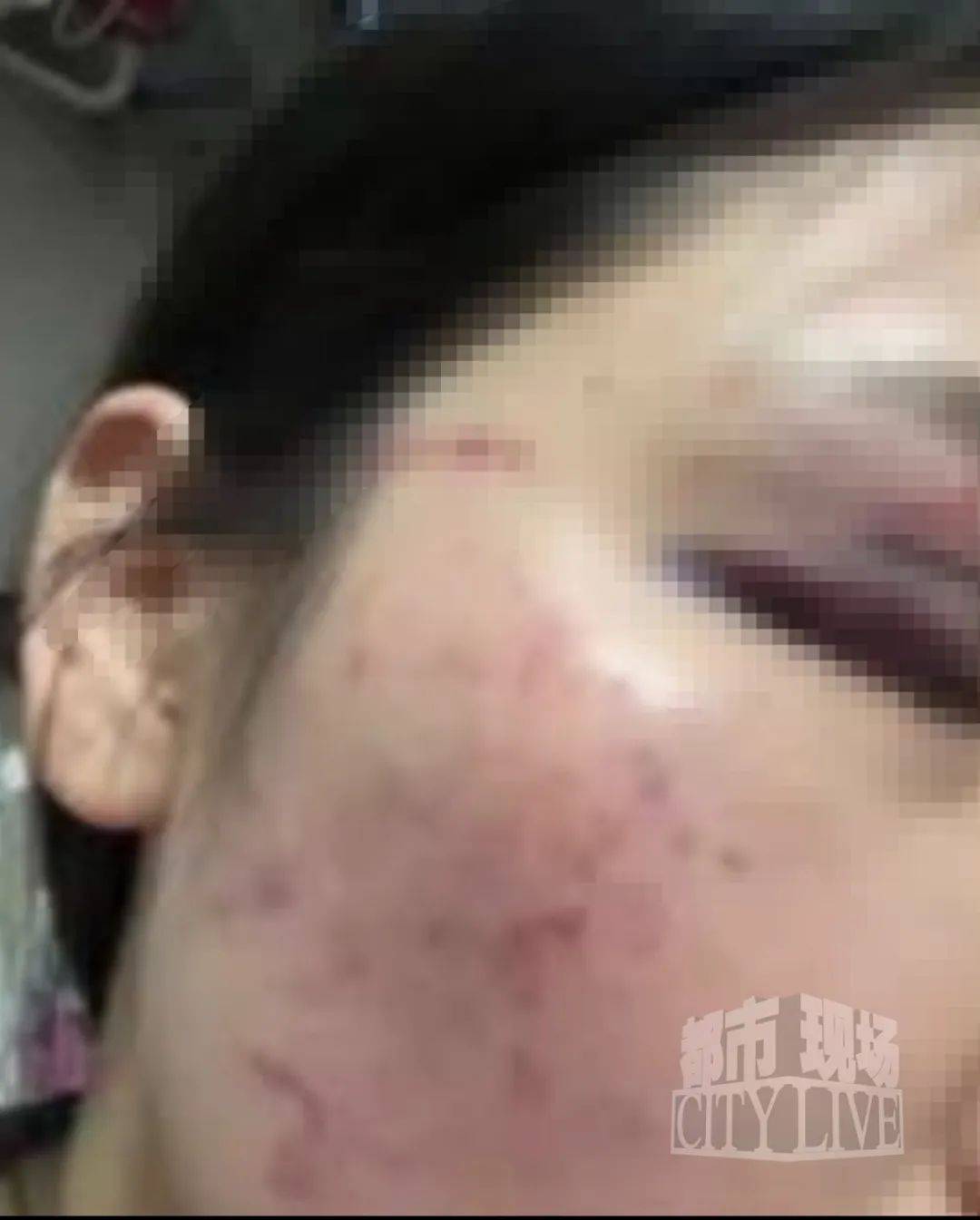 湖南衡阳29岁女子疑被男友施暴后从25楼跳下身亡 男友徐某此前还刺激说：“你放心<strong></p>
<p>网信</strong>，她不会去死的”