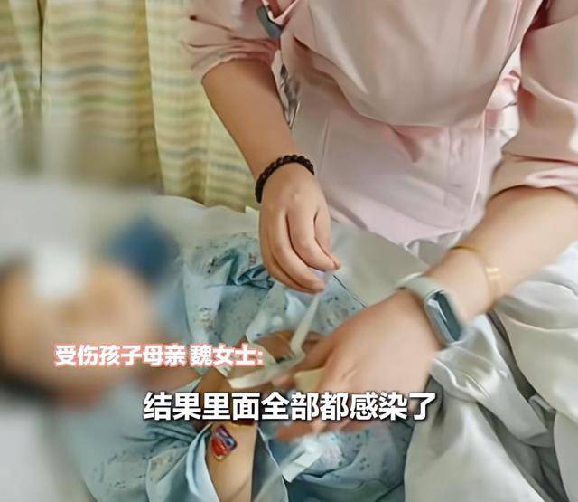 江西一5岁男孩在幼儿园被戳伤致左眼失明<strong></p>
<p>基础理财</strong>，家长称老师用猪油涂抹试图消肿