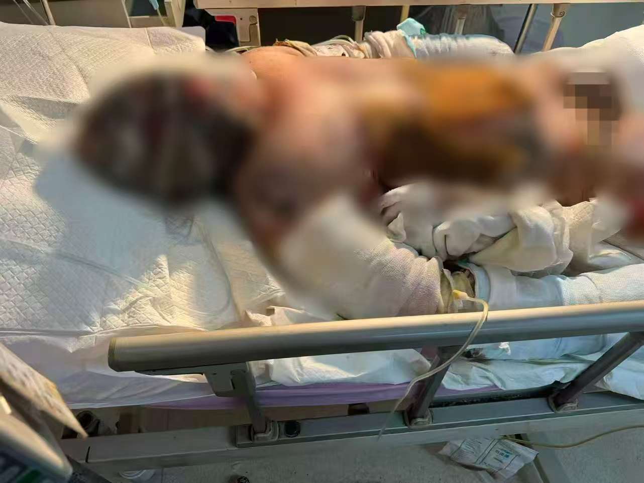父子在哈尔滨一亲戚公司上班遇爆炸全身烧伤<strong></p>
<p>理财教程</strong>，治疗花费近百万公司拒赔偿？亲戚回应