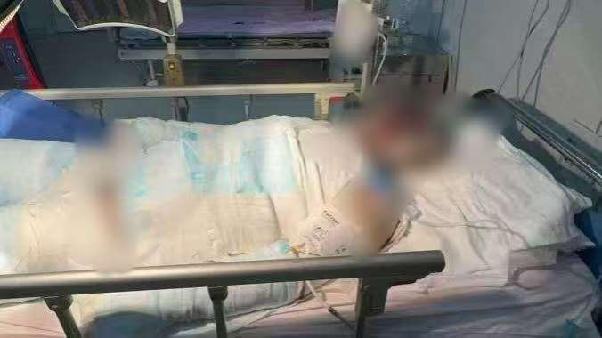 父子在哈尔滨一亲戚公司上班遇爆炸全身烧伤<strong></p>
<p>理财教程</strong>，治疗花费近百万公司拒赔偿？亲戚回应