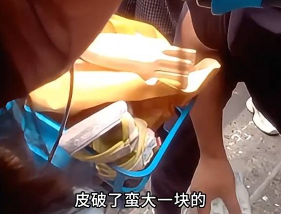 看着都疼<strong></p>
<p>理财钱包</strong>！上海街头一男子突然求助：10岁女儿被死死卡住！这个行为太危险→