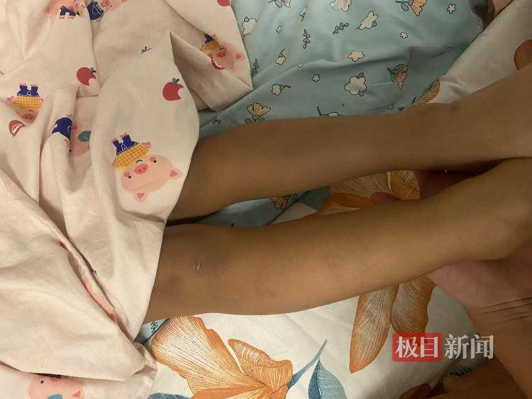 沈阳一女婴出生半年确诊“脊柱裂”<strong></p>
<p>理财的利率</strong>，宝妈称“大排畸”正常，涉事医师无产前诊断资质，当地卫健委介入