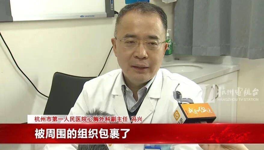 17岁小伙参军体检发现胸腔内有根5cm缝衣针<strong></p>
<p>理财书籍推荐</strong>，父母回忆或是1岁时扎入，取出时已锈迹斑斑